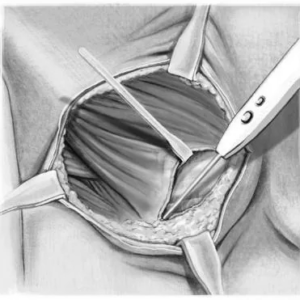 اسلولار درمال ماتریکس